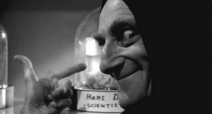 Yf_abbie_normal_brain_small